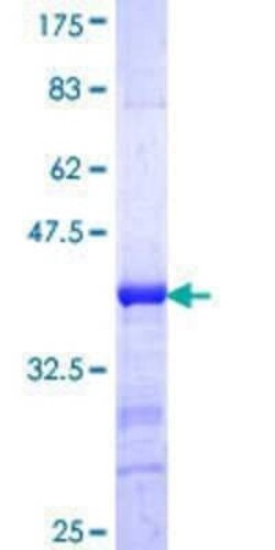 Novus Biologicals Recombinant Human PIBF1 GST (N-Term) Protein 10 &mu;g | Buy Online | Novus Biologicals&trade; | Fisher Scientific
