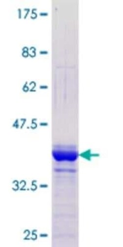 Novus Biologicals Recombinant Human ZNF238 GST (N-Term) Protein 10 &mu;g | Buy Online | Novus Biologicals&trade; | Fisher Scientific