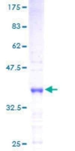 Novus Biologicals Recombinant Human NHC GST (N-Term) Protein 25 &mu;g | Buy Online | Novus Biologicals&trade; | Fisher Scientific