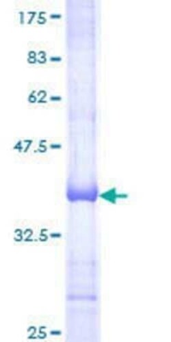 Novus Biologicals Recombinant Human TRIM38 GST (N-Term) Protein 25 &mu;g | Buy Online | Novus Biologicals&trade; | Fisher Scientific