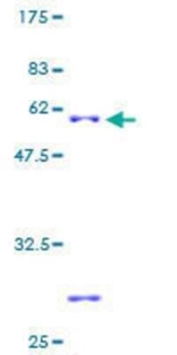 Novus Biologicals Recombinant Human SLC25A17 GST (N-Term) Protein 2 &mu;g | Buy Online | Novus Biologicals&trade; | Fisher Scientific