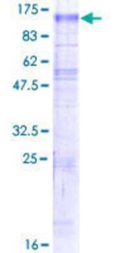 Novus Biologicals Recombinant Human NHE6/SLC9A6 GST (N-Term) Protein 2 &mu;g | Buy Online | Novus Biologicals&trade; | Fisher Scientific