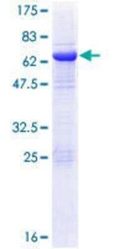 Novus Biologicals Recombinant Human EIF3M GST (N-Term) Protein 25 &mu;g | Buy Online | Novus Biologicals&trade; | Fisher Scientific