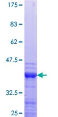 Novus Biologicals Recombinant Human NXF1 GST (N-Term) Protein 10 &mu;g | Buy Online | Novus Biologicals&trade; | Fisher Scientific