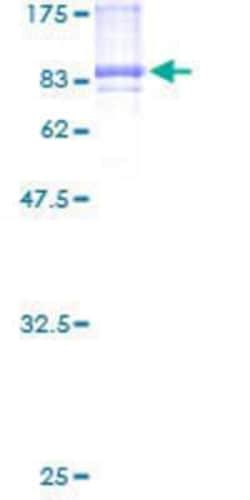 Novus Biologicals Recombinant Human CAP2 GST (N-Term) Protein 25 &mu;g | Buy Online | Novus Biologicals&trade; | Fisher Scientific