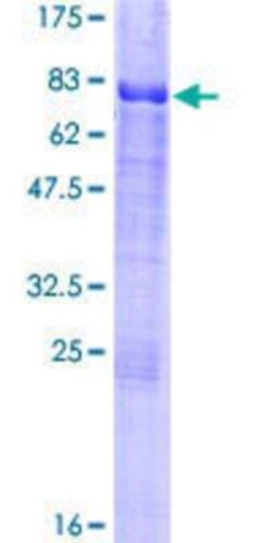 Novus Biologicals Recombinant Human CREB3 GST (N-Term) Protein 25 &mu;g | Buy Online | Novus Biologicals&trade; | Fisher Scientific