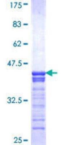 Novus Biologicals Recombinant Human CREB3 GST (N-Term) Protein 25 &mu;g | Buy Online | Novus Biologicals&trade; | Fisher Scientific