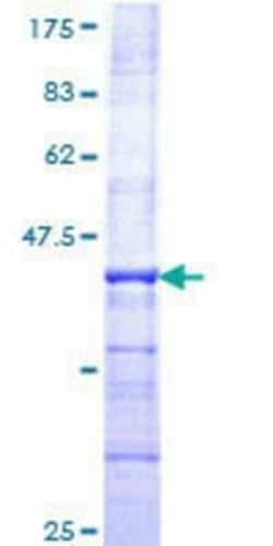 Novus Biologicals Recombinant Human LRRC41 GST (N-Term) Protein 25 &mu;g | Buy Online | Novus Biologicals&trade; | Fisher Scientific