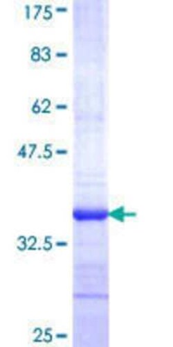 Novus Biologicals Recombinant Human ENOX2 GST (N-Term) Protein 10 &mu;g | Buy Online | Novus Biologicals&trade; | Fisher Scientific