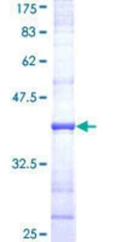 Novus Biologicals Recombinant Human UNC13B GST (N-Term) Protein 25 &mu;g | Buy Online | Novus Biologicals&trade; | Fisher Scientific
