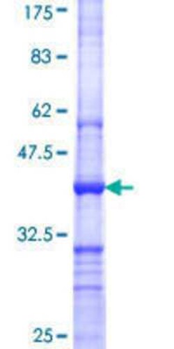 Novus Biologicals&trade;&nbsp;Recombinant Human Carm1 GST (N-Term) Protein