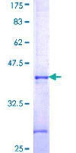 Novus Biologicals Recombinant Human APPBP2 GST (N-Term) Protein 25 &mu;g | Buy Online | Novus Biologicals&trade; | Fisher Scientific