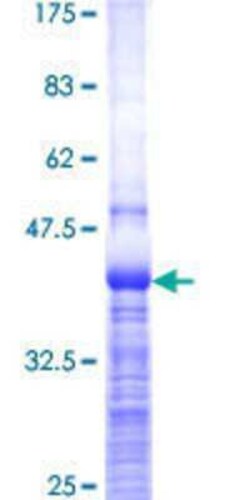 Novus Biologicals Recombinant Human MYBBP1A GST (N-Term) Protein 25 &mu;g | Buy Online | Novus Biologicals&trade; | Fisher Scientific