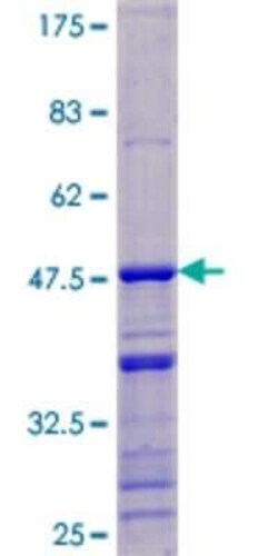 Novus Biologicals Recombinant Human DDX17 GST (N-Term) Protein 10 &mu;g | Buy Online | Novus Biologicals&trade; | Fisher Scientific
