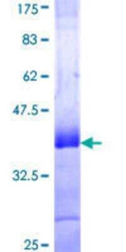 Novus Biologicals Recombinant Human DEAF1 GST (N-Term) Protein 10 &mu;g | Buy Online | Novus Biologicals&trade; | Fisher Scientific