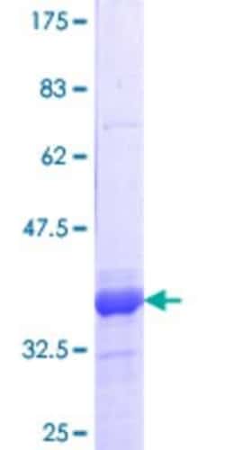 Novus Biologicals Recombinant Human DEAF1 GST (N-Term) Protein 25 &mu;g | Buy Online | Novus Biologicals&trade; | Fisher Scientific