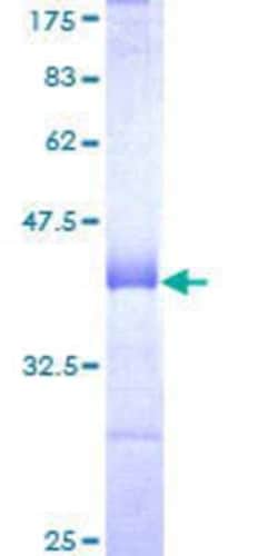 Novus Biologicals Recombinant Human CHERP GST (N-Term) Protein 25 &mu;g | Buy Online | Novus Biologicals&trade; | Fisher Scientific