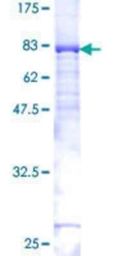Novus Biologicals Recombinant Human TIP60 GST (N-Term) Protein 2 &mu;g | Buy Online | Novus Biologicals&trade; | Fisher Scientific