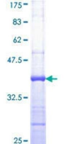 Novus Biologicals Recombinant Human TIP60 GST (N-Term) Protein 10 &mu;g | Buy Online | Novus Biologicals&trade; | Fisher Scientific