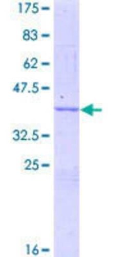 Novus Biologicals Recombinant Human ORP150/HSP12A GST (N-Term) Protein 25 &mu;g | Buy Online | Novus Biologicals&trade; | Fisher Scientific