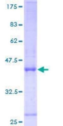 Novus Biologicals Recombinant Human ORP150/HSP12A GST (N-Term) Protein 25 &mu;g | Buy Online | Novus Biologicals&trade; | Fisher Scientific
