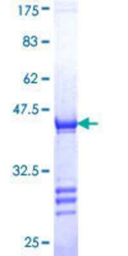 Novus Biologicals Recombinant Human ORP150/HSP12A GST (N-Term) Protein 25 &mu;g | Buy Online | Novus Biologicals&trade; | Fisher Scientific