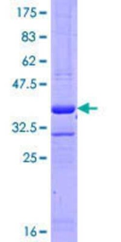 Novus Biologicals Recombinant Human Importin-8 GST (N-Term) Protein 10 &mu;g | Buy Online | Novus Biologicals&trade; | Fisher Scientific