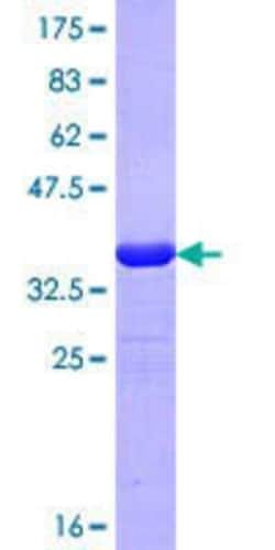Novus Biologicals Recombinant Human Importin-7 GST (N-Term) Protein 25 &mu;g | Buy Online | Novus Biologicals&trade; | Fisher Scientific