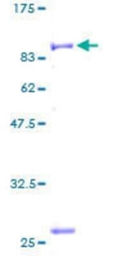 Novus Biologicals Recombinant Human PITRM1 GST (N-Term) Protein 2 &mu;g | Buy Online | Novus Biologicals&trade; | Fisher Scientific