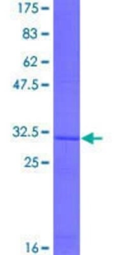 Novus Biologicals Recombinant Human AGPAT2 GST (N-Term) Protein 10 &mu;g | Buy Online | Novus Biologicals&trade; | Fisher Scientific