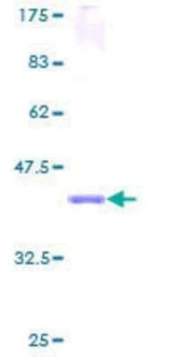 Novus Biologicals Recombinant Human SPTLC1 GST (N-Term) Protein 10 &mu;g | Buy Online | Novus Biologicals&trade; | Fisher Scientific