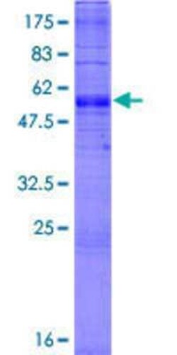 Novus Biologicals Recombinant Human SLC35A1 GST (N-Term) Protein 2 &mu;g | Buy Online | Novus Biologicals&trade; | Fisher Scientific