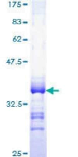 Novus Biologicals Recombinant Human SLC19A2 GST (N-Term) Protein 25 &mu;g | Buy Online | Novus Biologicals&trade; | Fisher Scientific