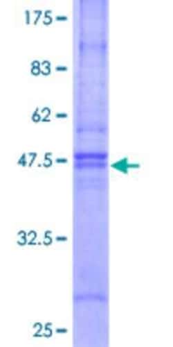 Novus Biologicals Recombinant Human PRA1 GST (N-Term) Protein 10 &mu;g | Buy Online | Novus Biologicals&trade; | Fisher Scientific