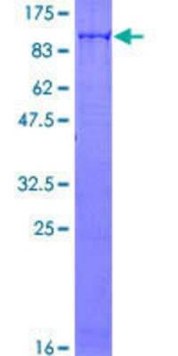 Novus Biologicals&trade;&nbsp;Recombinant Human SLU7 GST (N-Term) Protein