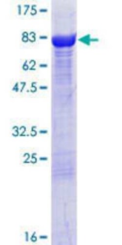 Novus Biologicals Recombinant Human DPYSL4 GST (N-Term) Protein 10 &mu;g | Buy Online | Novus Biologicals&trade; | Fisher Scientific
