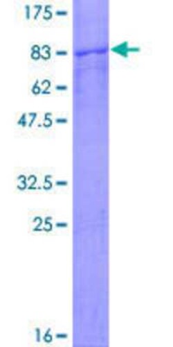 Novus Biologicals&trade;&nbsp;Recombinant Human TCP1-eta GST (N-Term) Protein
