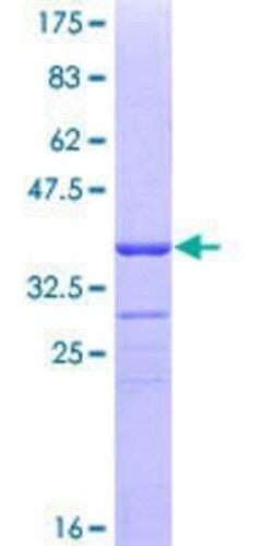 Novus Biologicals Recombinant Human TCP1-beta GST (N-Term) Protein 25 &mu;g | Buy Online | Novus Biologicals&trade; | Fisher Scientific