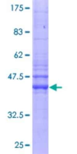 Novus Biologicals&trade;&nbsp;Recombinant Human IFITM2 GST (N-Term) Protein