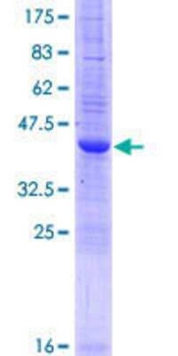 Novus Biologicals Recombinant Human IFITM2 GST (N-Term) Protein 25 &mu;g | Buy Online | Novus Biologicals&trade; | Fisher Scientific