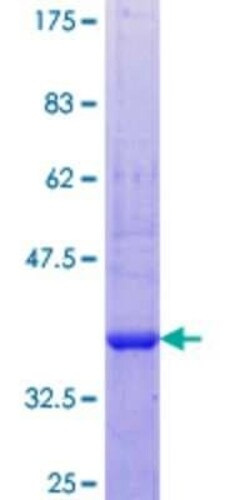 Novus Biologicals Recombinant Human COLEC10 GST (N-Term) Protein 10 &mu;g | Buy Online | Novus Biologicals&trade; | Fisher Scientific