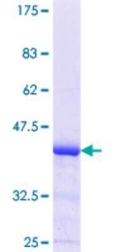 Novus Biologicals Recombinant Human POMT1 GST (N-Term) Protein 25 &mu;g | Buy Online | Novus Biologicals&trade; | Fisher Scientific