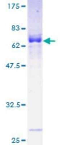 Novus Biologicals Recombinant Human MAB21L2 GST (N-Term) Protein 25 &mu;g | Buy Online | Novus Biologicals&trade; | Fisher Scientific