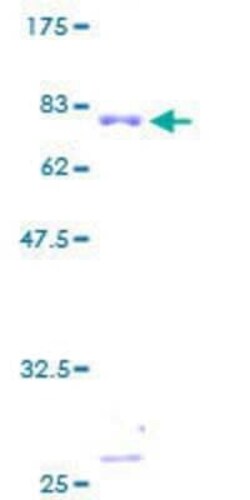 Novus Biologicals Recombinant Human TXNRD2 GST (N-Term) Protein 10 &mu;g | Buy Online | Novus Biologicals&trade; | Fisher Scientific