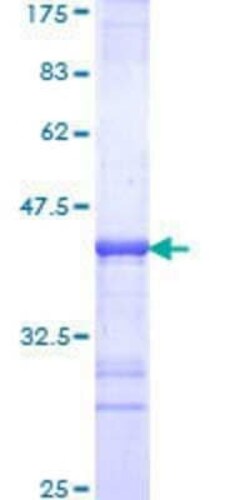 Novus Biologicals Recombinant Human DRAP1 GST (N-Term) Protein 10 &mu;g | Buy Online | Novus Biologicals&trade; | Fisher Scientific
