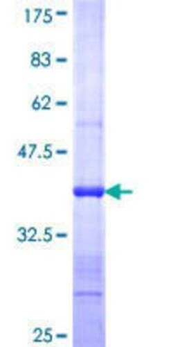 Novus Biologicals Recombinant Human SMC2 GST (N-Term) Protein 10 &mu;g | Buy Online | Novus Biologicals&trade; | Fisher Scientific
