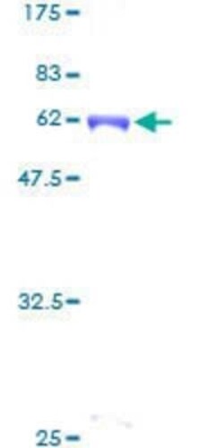 Novus Biologicals Recombinant Human CDC42EP3 GST (N-Term) Protein 2 &mu;g | Buy Online | Novus Biologicals&trade; | Fisher Scientific