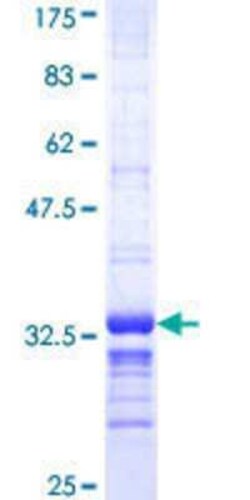 Novus Biologicals Recombinant Human CDC42EP3 GST (N-Term) Protein 10 &mu;g | Buy Online | Novus Biologicals&trade; | Fisher Scientific