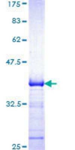 Novus Biologicals Recombinant Human SH2B2 GST (N-Term) Protein 10 &mu;g | Buy Online | Novus Biologicals&trade; | Fisher Scientific