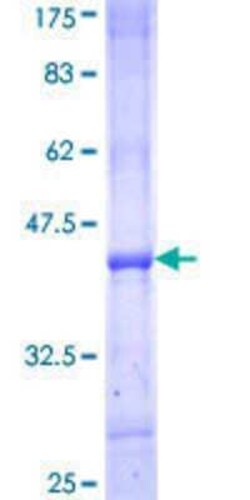 Novus Biologicals Recombinant Human SC65 GST (N-Term) Protein 10 &mu;g | Buy Online | Novus Biologicals&trade; | Fisher Scientific